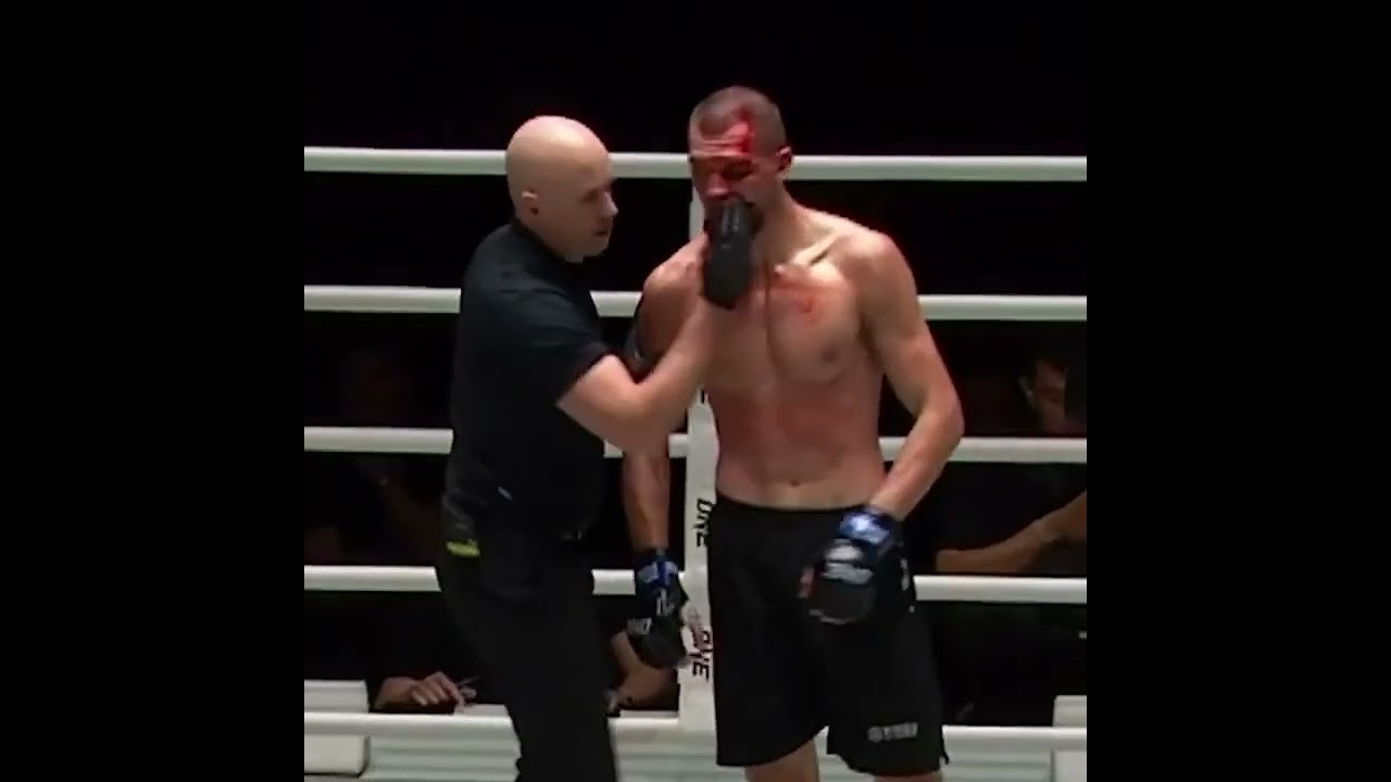 We’ve got a mouthpiece situation here